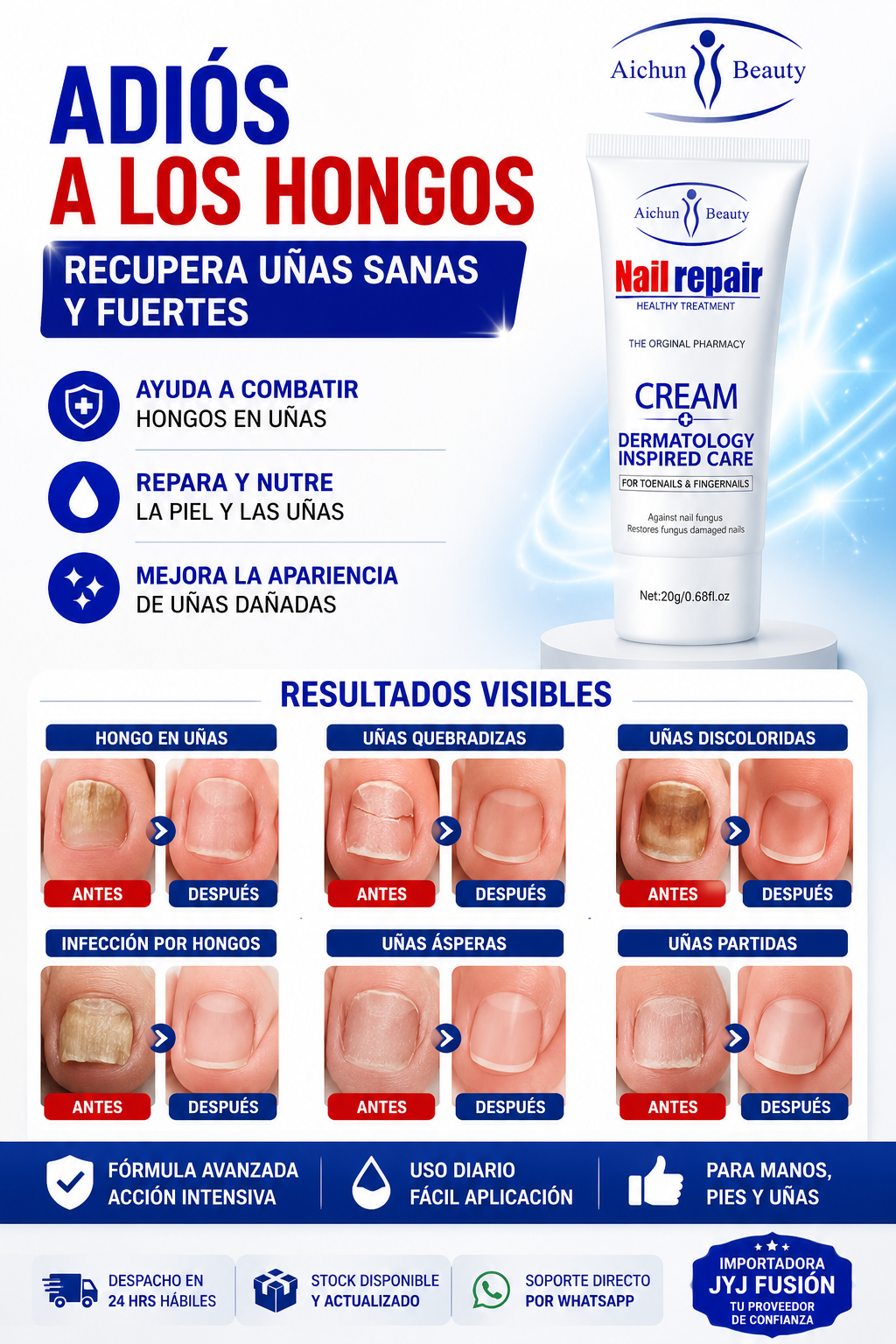 CREMA ANTI HONGOS