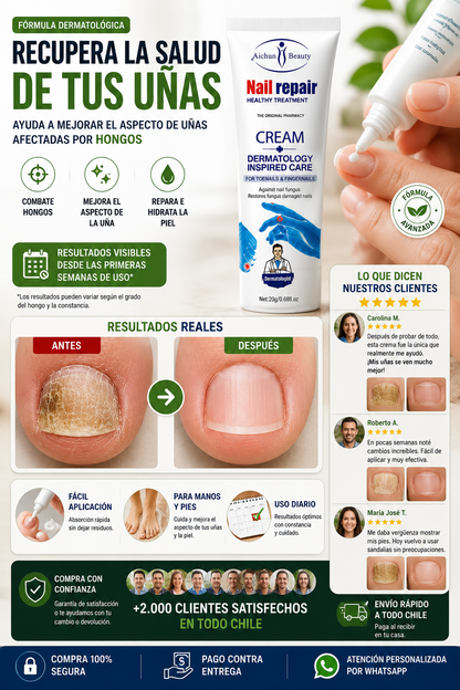 CREMA ANTI HONGOS